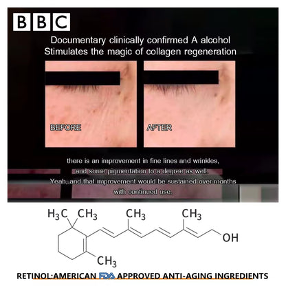 Retinol Face Cream – Moisturize, Brighten & Smooth