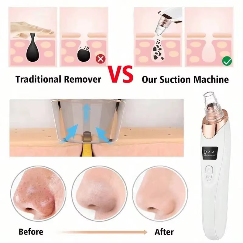 Electric Pore Cleaner & Blackhead Remover – Deep Cleansing Facial Vacuum Tool